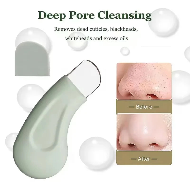 Blackhead & Whitehead Remover Tool for Nose and Face